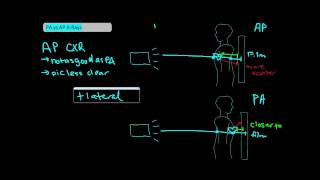 Types of Chest XRays part 1  AP vs PA UndergroundMed [upl. by Adley]