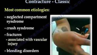 Volkmanns Ischemic Contracture Classic  Everything You Need To Know  Dr Nabil Ebraheim [upl. by Suiradel670]