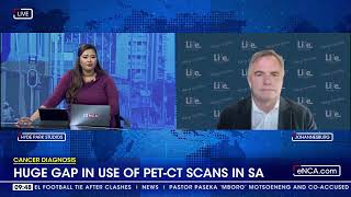 Cancer Diagnosis  Huge gap in use of PETCT scans in SA [upl. by Asyram]