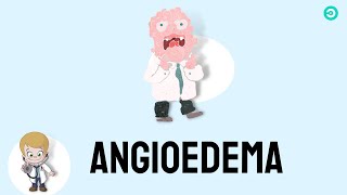 Angioedema signs amp symptoms causes and treatment [upl. by Arlinda]