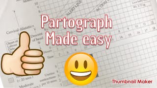 partograph made easy [upl. by Illehs]