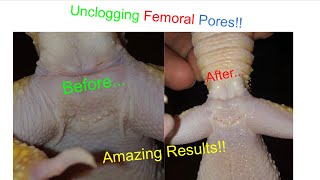 How To Unclog Femoral Pores [upl. by Acireh]