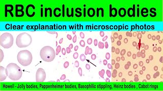 Inclusion bodies  red blood cell inclusions bodiesdetailsmicroscopic photos [upl. by Brosy]