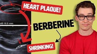 Berberine shrinks Arterial Plaque Study Shows [upl. by Laband]