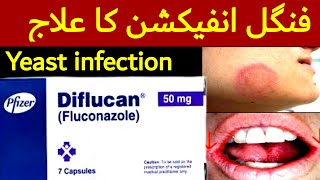 diflucan 150mg 1 capsule in urdu  diflucan capsule  diflucan fluconazole  diflucan 150 mg [upl. by Aseeram]