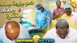 சம்பத்கான் கு முடி நட்டாச்சு  Hair Plantation  WFT Vlog [upl. by Fay916]