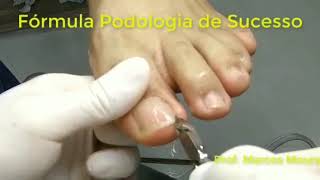 Curso de Podologia online [upl. by Carmelita]