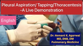 Pleural Aspiration Pleural Tapping Thoracentesis Needle Pleurocentesiss English [upl. by Gabbert]