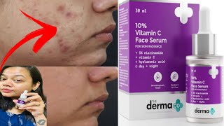 The Derma Co 10 VITAMIN C Face Serum with Vitamin C Niacinamide amp Hyaluronic Acid [upl. by Nydroj678]