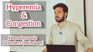 Hyperemia and Congestion  Hemodynamic disorders by Abdul Waheed Urdu Hindi lecture [upl. by Nnaeilsel]