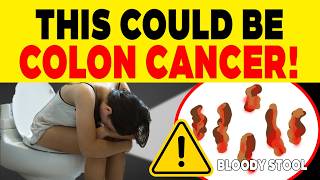 Warning Signs of Colon Cancer To Recognise Before Its Too Late [upl. by Qiratla601]