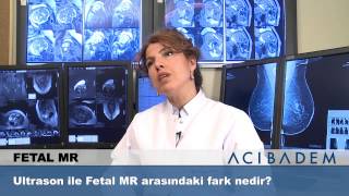 Ultrason ile Fetal MR arasındaki fark nedir [upl. by Anattar]