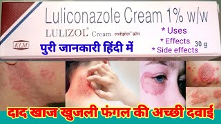 Lulizol Creamदाद खाज खुजली फंगल की अच्छी दवाई Luliconazole Cream 1ww Review in Hindi Uses Fungale [upl. by Yatnwahs159]