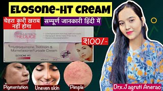 ElosoneHT Cream Indetail  ElosoneHT Cream Review  Gora Aur Saf Chehra  skin brightening cream [upl. by Raddy]