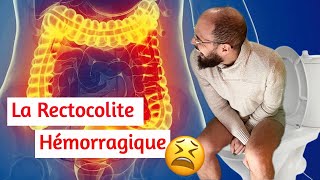 LA RECTOCOLITE HÉMORRAGIQUE  Quand aller aux toilettes devient un enfer  😰 [upl. by Suollecram]