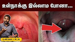 நமக்கு உள்நாக்கு இருக்குறது இதுக்காகத் தான்🙄  Uvula problems explained  Uyirmei Ep36 [upl. by Acireh790]