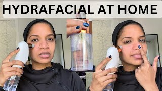 hydrafacial at home  before and after treatment [upl. by Tatianas784]