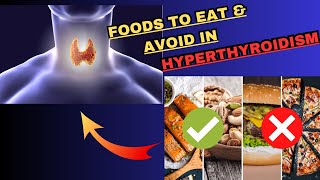 Hyperthyroidism Diet Plan  Hyperthyroidism Foods to Eat amp Foods to Avoid  Hyperthyroidism Symptoms [upl. by Cirdor]