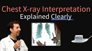 Chest XRay Interpretation Explained Clearly  How to read a CXR [upl. by Timofei]