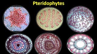 Types of Stele and its Evolution in Pteridophytes [upl. by Anaujait]