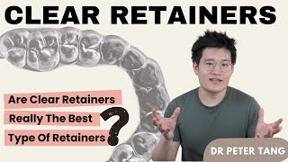 Are Clear Retainers The Best Type Of Retainers [upl. by Gillespie]