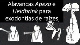 Alavancas Apexo e Heidbrinnk para exodontias de raizes  Odontologia  Dra Bianca Rosa [upl. by Fante]