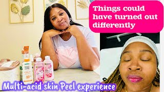 My MultiAcid Skin Peel Journey  Day 1  14 [upl. by Yart]