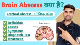 Brain Abscess Lecture in Hindi  Causes Symptoms And Treatment of Brain Abscess [upl. by Cayla]