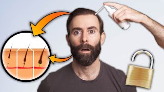 El Secreto Para Multiplicar X 4 Tus Resultados Con Minoxidil [upl. by Hcnarb]