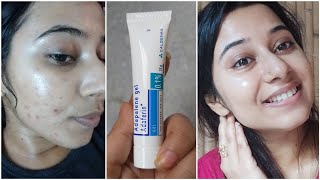 Apply Vaseline amp Turmeric on Face to Remove DARK SPOTS in 3 Days  Best Collagen Cream for Wrinkles [upl. by Aieka]