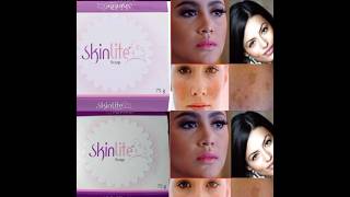 Skinlite Soap Review  Uses and Side Effects  कैसे यूज़ करे how to use skin light soap [upl. by Constance32]