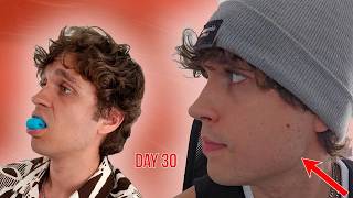 30Day Jaw Exerciser Challenge Does It Really Work [upl. by Verner]