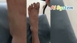 Surface marking of Dorsalis Pedis Artery  1st Prof MBBS Examination  MH Samorita Medical College [upl. by Nilesoy932]