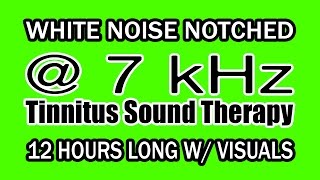 White Noise  Notch Filtered at 7 kHz for Tinnitus Therapy w Visuals [upl. by Billye]