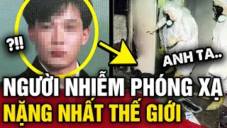 Chàng trai người Nhật NHIỄM PHÓNG XẠ nặng nhất thế giới và 83 ngày ĐỊA NGỤC  Tin 3 Phút [upl. by Tessi195]