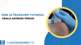 MSK ultrasound of the tibialis anterior tendon [upl. by Auhsaj515]