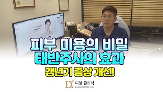 피부 미용의 비밀 태반주사의 효과와 갱년기 증상 개선 [upl. by Tomlinson]