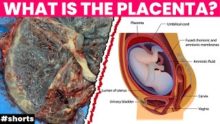 PLACENTA PREVIA  What is Placenta previa  Modvr3D [upl. by Noseimaj420]