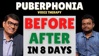 Amazing Voice Transformation Before amp After Puberphonia Therapy in Just 8 Days  SLPSanjayKumar [upl. by Ikila]