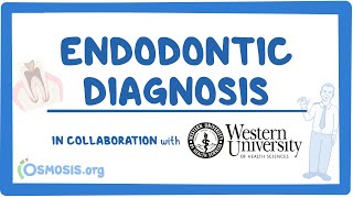 Endodontic Diagnosis in Collaboration w Western University [upl. by Britney50]