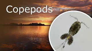 Copepods Cyclops Under a Microscope Description Habitat and Anatomy [upl. by Su]