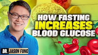 Fasting and Blood Glucose  Jason Fung [upl. by Gobert878]