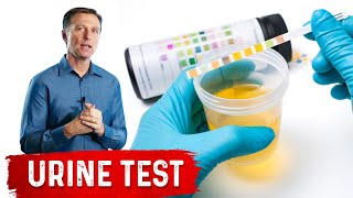 Urine Test Simplified [upl. by Cartan]