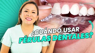 ¿Cuándo usar unas férulas dentales [upl. by Nohtiek]