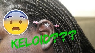 ONE MONTH INDUSTRIAL PIERCING UPDATE  KELOID amp PAIN [upl. by Netsirhk951]