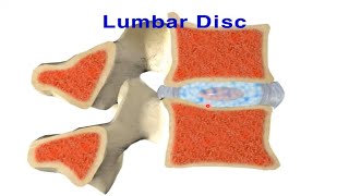 Lumbar disc  nucleus pulposus and annulus fibrosus [upl. by Grange]