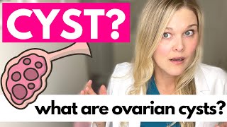 OVARIAN CYSTS What Causes Ovarian Cysts [upl. by April673]