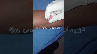 Intravenous cannulation procedure medico virlshort viral shotrs [upl. by Nyved55]