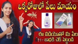 ఏ side effects లేకుండా low budget లో ఒక్క రోజులో పేలు మాయం Clear head lice amp Nits  Anjali Trends [upl. by Norval]