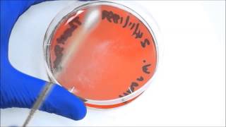 Oropharyngeal swab followed by streak plate technique [upl. by Patnode]